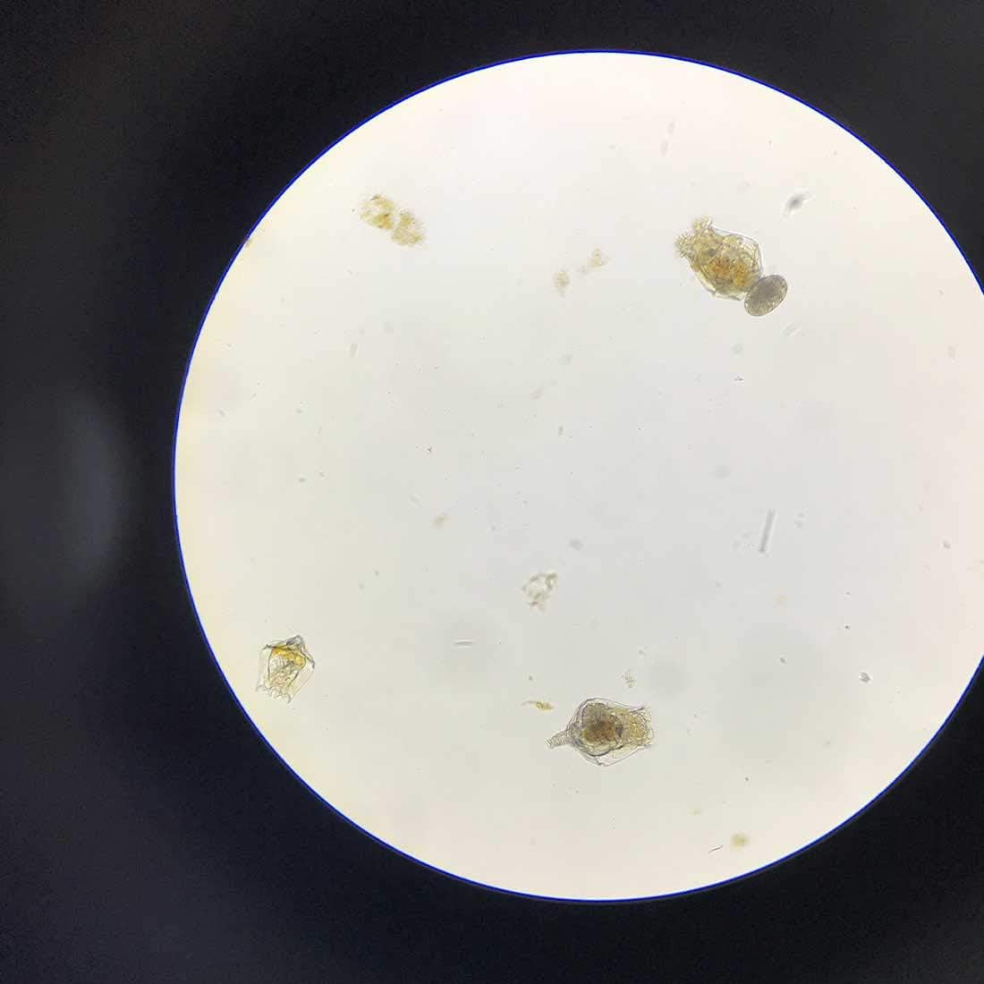 Greenwaterfarm Rotifers Brachionus Calyciflorus Pallas Eggs Live Fish Food for H